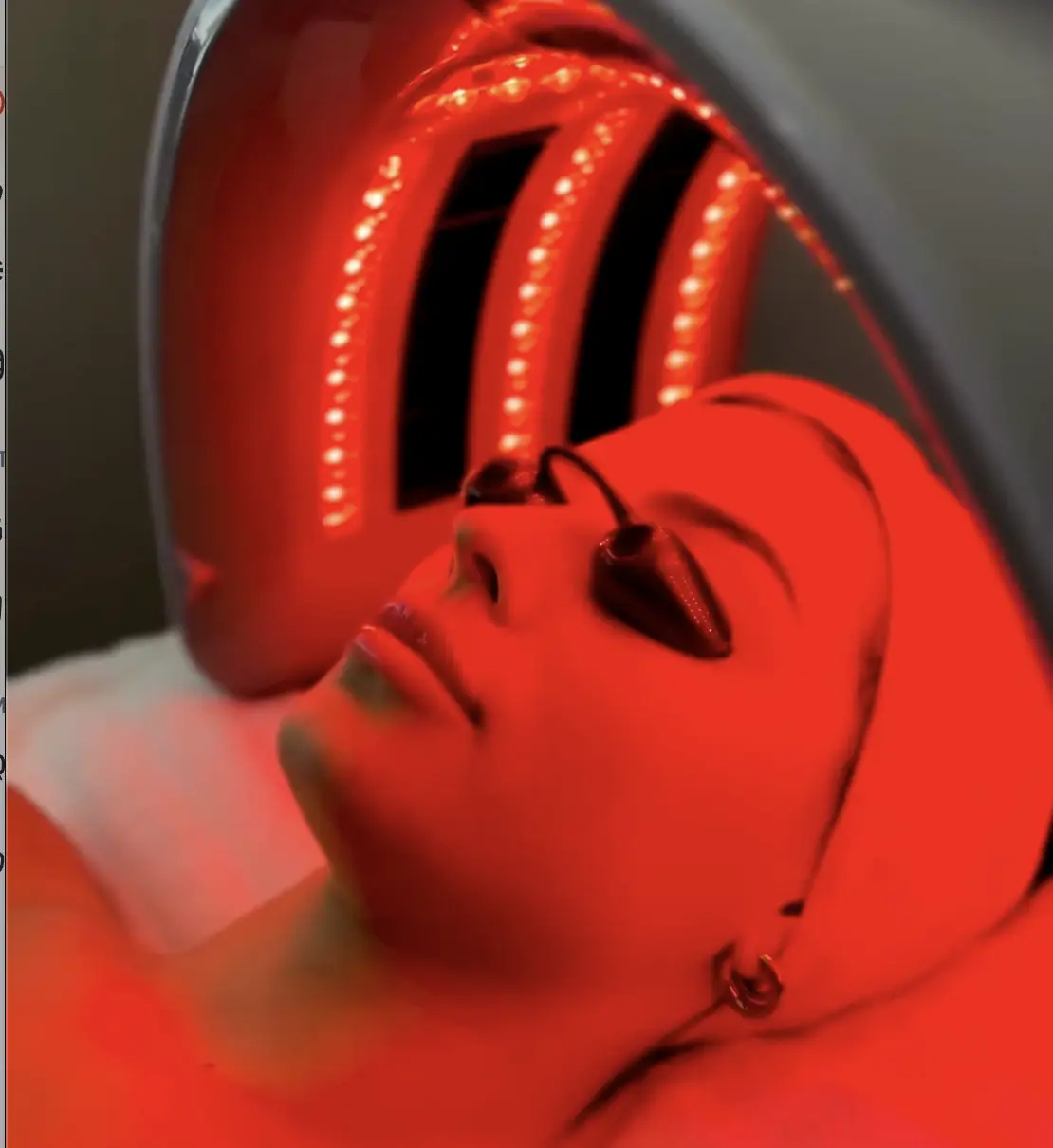 Red light therapy treatment